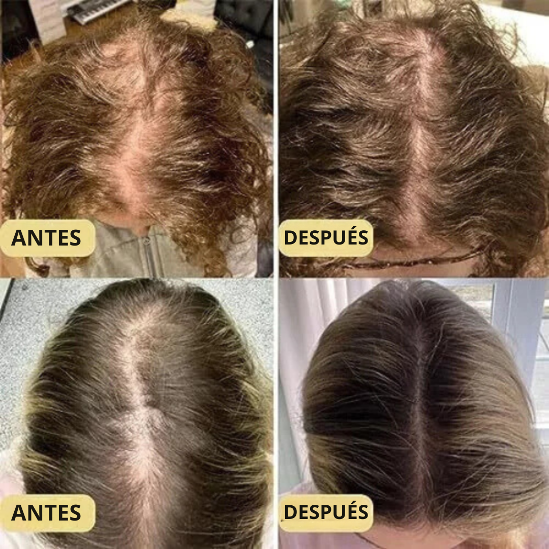 Aceite Capilar Vegano – Fortalece y Estimula el Crecimiento