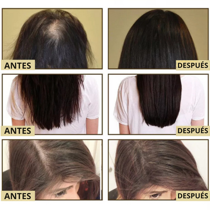 Aceite Capilar Vegano – Fortalece y Estimula el Crecimiento